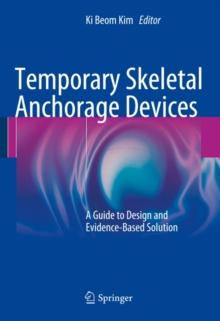 Temporary Skeletal Anchorage Devices : A Guide to Design and Evidence-Based Solution