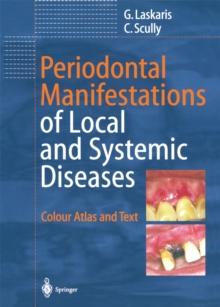 Periodontal Manifestations of Local and Systemic Diseases : Colour Atlas and Text