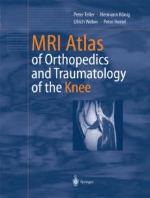 MRI Atlas of Orthopedics and Traumatology of the Knee