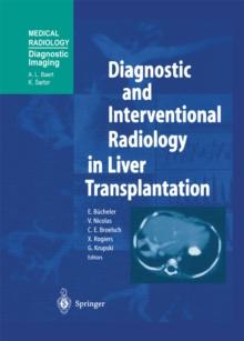 Diagnostic and Interventional Radiology in Liver Transplantation