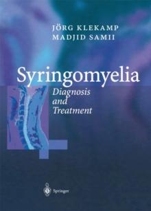 Syringomyelia : Diagnosis and Treatment