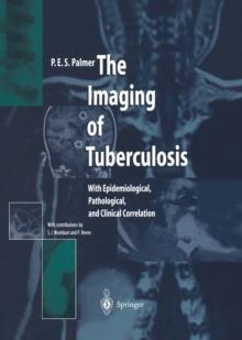 The Imaging of Tuberculosis : With Epidemiological, Pathological, and Clinical Correlation