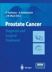 Prostate Cancer : Diagnosis and Surgical Treatment