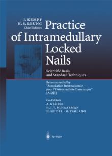 Practice of Intramedullary Locked Nails : Scientific Basis and Standard Techniques Recommended "Association Internationale pour I'Osteosynthese Dynamique" (AIOD)