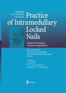 Practice of Intramedullary Locked Nails : Advanced Techniques and Special Applications Recommended by "Association Internationale pour l'Osteosynthese Dynamique" (AIOD)