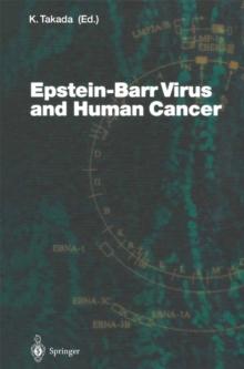 Epstein-Barr Virus and Human Cancer