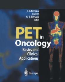 PET in Oncology : Basics and Clinical Application