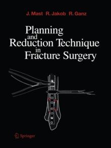 Planning and Reduction Technique in Fracture Surgery