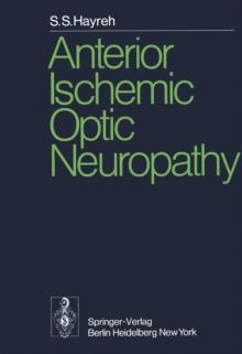 Anterior Ischemic Optic Neuropathy