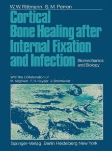 Cortical Bone Healing after Internal Fixation and Infection : Biomechanics and Biology