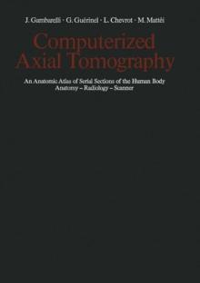 Computerized Axial Tomography : An Anatomic Atlas of Serial Sections of the Human Body Anatomy - Radiology - Scanner