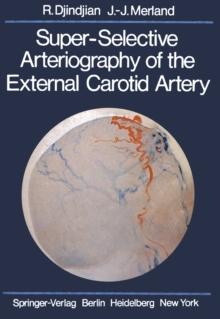 Super-Selective Arteriography of the External Carotid Artery