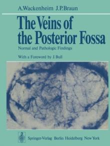 The Veins of the Posterior Fossa : Normal and Pathologic Findings