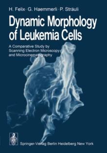 Dynamic Morphology of Leukemia Cells : A Comparative Study by Scanning Electron Microscopy and Microcinematography