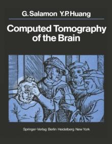 Computed Tomography of the Brain : Atlas of Normal Anatomy