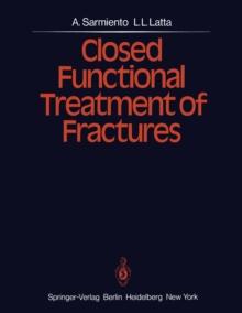 Closed Functional Treatment of Fractures