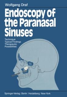 Endoscopy of the Paranasal Sinuses : Technique * Typical Findings Therapeutic Possibilities