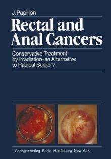 Rectal and Anal Cancers : Conservative Treatment by Irradiation - an Alternative to Radical Surgery