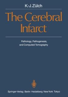 The Cerebral Infarct : Pathology, Pathogenesis, and Computed Tomography