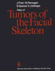 Atlas of Tumors of the Facial Skeleton : Odontogenic and Nonodontogenic Tumors