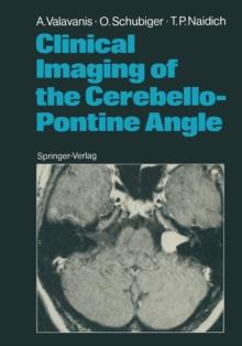 Clinical Imaging of the Cerebello-Pontine Angle