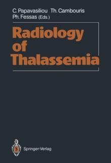 Radiology of Thalassemia