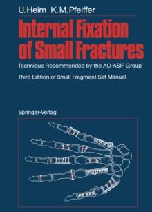 Internal Fixation of Small Fractures : Technique Recommended by the AO-ASIF Group