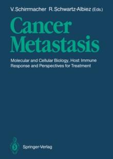 Cancer Metastasis : Molecular and Cellular Biology, Host Immune Responses and Perspective for Treatment