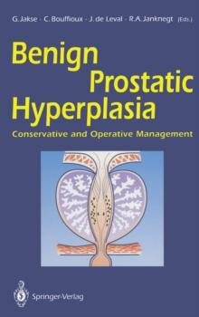 Benign Prostatic Hyperplasia : Conservative and Operative Management