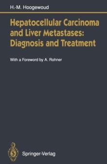 Hepatocellular Carcinoma and Liver Metastases: Diagnosis and Treatment