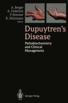 Dupuytren's Disease : Pathobiochemistry and Clinical Management