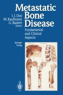 Metastatic Bone Disease : Fundamental and Clinical Aspects