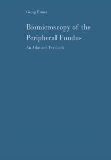 Biomicroscopy of the Peripheral Fundus : An Atlas and Textbook