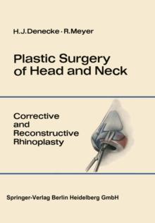 Plastic Surgery of Head and Neck : Volume I: Corrective and Reconstructive Rhinoplasty