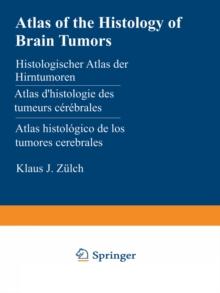 Atlas of the Histology of Brain Tumors / Histologischer Atlas der Hirntumoren / Atlas d'histologie des tumeurs cerebrales / Atlas histologico de los tumores cerebrales / ??????????????? ????? ????????