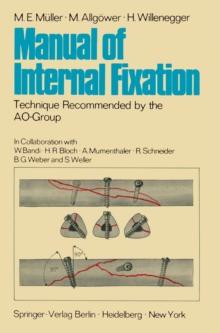 Manual of Internal Fixation : Technique Recommended by the AO-Group Swiss Association for the Study of Internal Fixation: ASIF