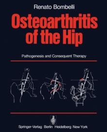 Osteoarthritis of the Hip : Pathogenesis and Consequent Therapy