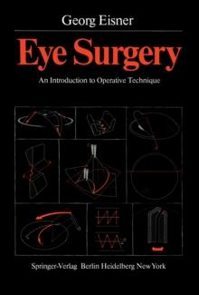 Eye Surgery : An Introduction to Operative Technique