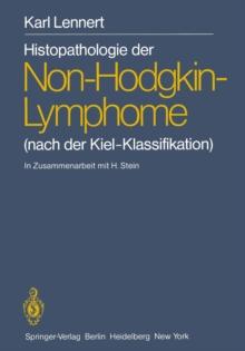 Histopathologie der Non-Hodgkin-Lymphome : (nach der Kiel-Klassifikation)