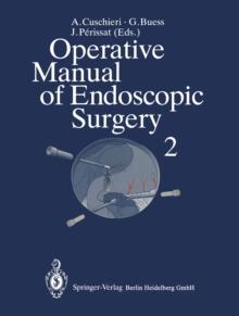 Operative Manual of Endoscopic Surgery 2