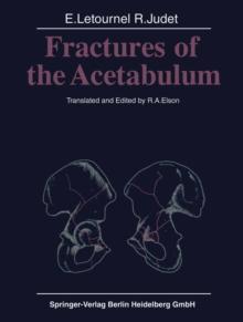 Fractures of the Acetabulum