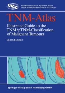 TNM-Atlas : Illustrated Guide to the TNM/pTNM-Classification of Malignant Tumours