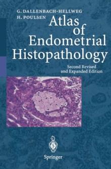 Atlas of Endometrial Histopathology