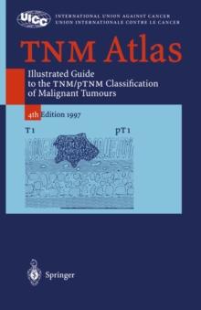 TNM Atlas : Illustrated Guide to the TNM/pTNM-Classification of Malignant Tumours