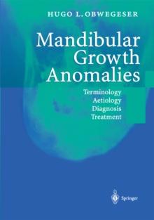 Mandibular Growth Anomalies : Terminology - Aetiology Diagnosis - Treatment