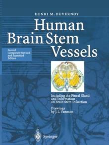 Human Brain Stem Vessels : Including the Pineal Gland and Information on Brain Stem Infarction