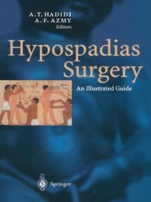 Hypospadias Surgery : An Illustrated Guide