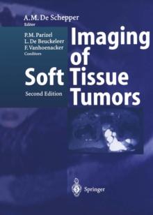 Imaging of Soft Tissue Tumors