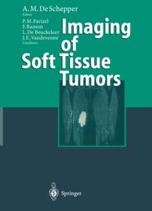 Imaging of Soft Tissue Tumors