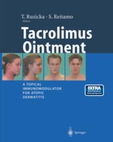 Tacrolimus Ointment : A Topical Immunomodulator for Atopic Dermatitis